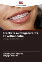 Suruchi Jatol-Tekade (U. A.) | Brackets Autoligaturants En Orthodontie | Buch