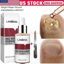 LANBENA Nail Repair Essence Remove Onychomycosis Serum Fungal Nail Treatment