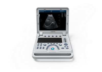 CONTEC CMS1700B Color Doppler Ultrasonic Diagnostic System + abdominal probe