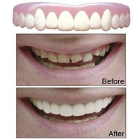 Imako Cosmetic Upper Teeth 1 Pack (large, Bleached) Imako Cosmetic Upper Teeth 1 Pack (large, Bleached)