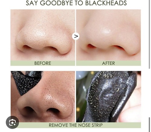 Blackhead Remover Strips Nose Pore Cleansing Peel Off Mask Sticker Acne Blemish - Picture 3 of 3