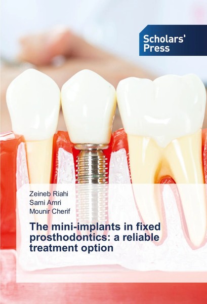 Zeineb Riahi (U. A.) | The Mini-Implants In Fixed Prosthodontics: A Reliable...-image