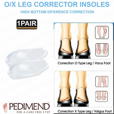 PEDIMEND O/X Type Leg Orthopedic Insole Corrects Over-Pronation Heel Gel Insoles Inserts