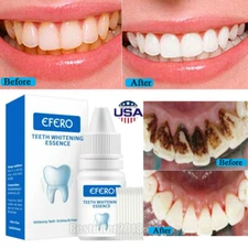 Teeth Whitening Serum Gel Oral Hygiene Teeth Clean Dental Care Cotton Swab Kit