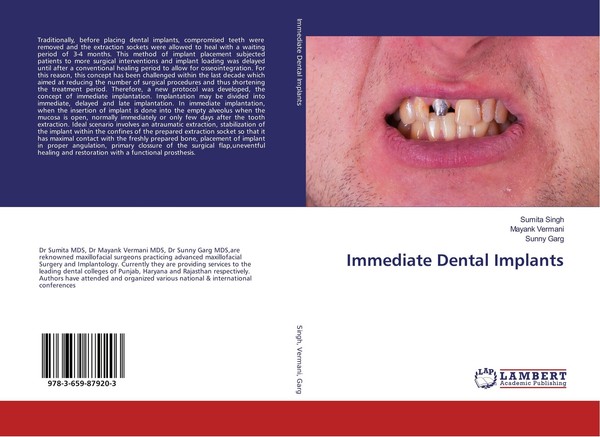 Immediate Dental Implants Sumita Singh-image