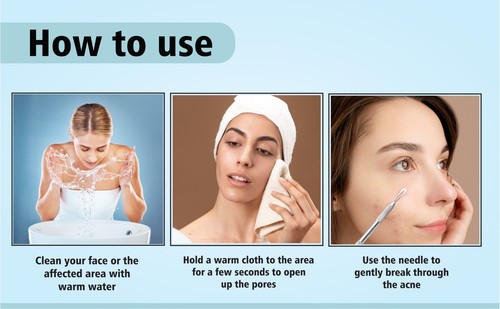 Extractor de espinillas faciales para espinillas herramienta removedora de limpiadores faciales de acero inoxidable, unisex - Imagen 16 de 16