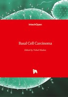 Vishal Madan | Basal Cell Carcinoma | Buch | Englisch (2012) | 136 S.