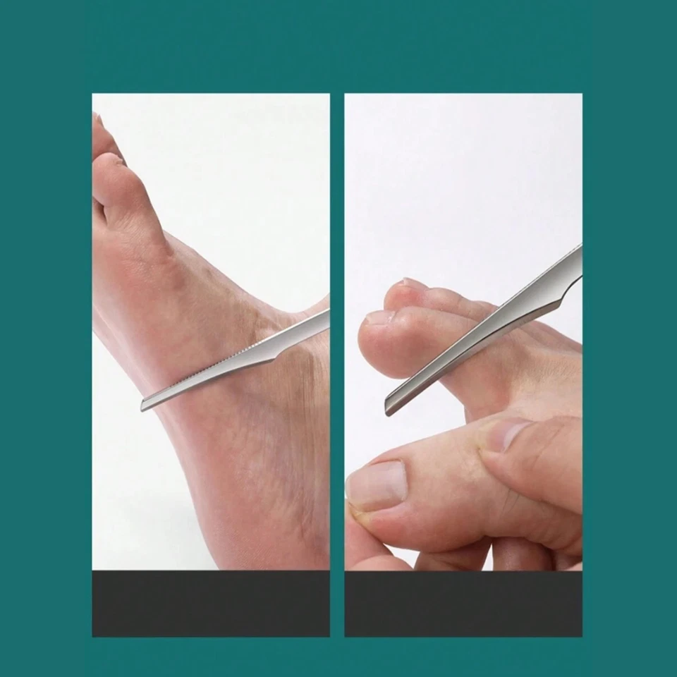 1set Foot Callus Remover - Exfoliating Scraper for Dead Skin & Daily Foot Care - Image 3 of 4