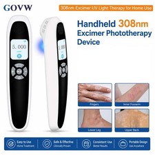 308nm UVB Light Therapy Device Portable Excimer Phototherapy Skin Care 20mW/cm2