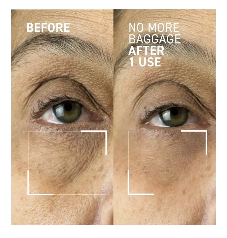 Dr. Brandt Needles No More, No More Baggage - Minimizes Under-Eye Bags - Image 3 of 4