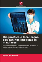 Nadia Al-Ansari | DiagnóStico E LocalizaçãO Dos Caninos Impactados Maxilares