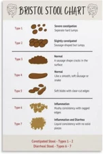Bristol Stool Chart Poster Healthy Poop Bowel Movement Bowel Examination Poster