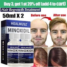 5 Minoxidil Hair Regrowth Treatment 50ML Hair Loss  Growth Scalp Liquid Men