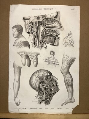 Antique Illustration 1834 Anatomy Medicine Surgery Doctor Doctor Botany