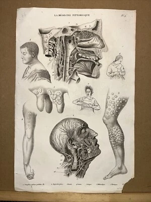 Antiquarische Illustration 1834 Anatomie Medizine Chirurgie Arzt Doktor Botanik - Bild 1 von 4