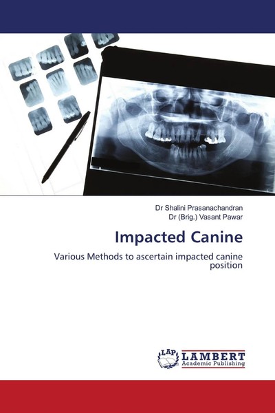 Shalini Prasanachandran (U. A.) | Impacted Canine | Taschenbuch | Englisch-image