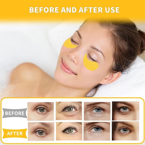 Under Eye Patches 70PCS, 24K Gold Eye Patches for Puffy Eyes Treatment, under Ey - Picture 6 of 12