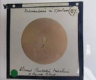 Tuberculosis  Natural History Magic Lantern Slide from microscope image