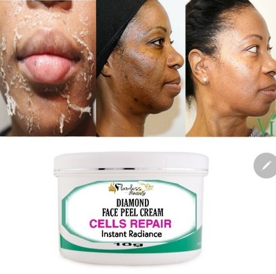 skin lightening cream for babies