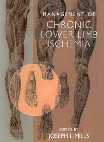 Management of Chronic Lower Limb Ischemia by Joseph Mills (2000 ...