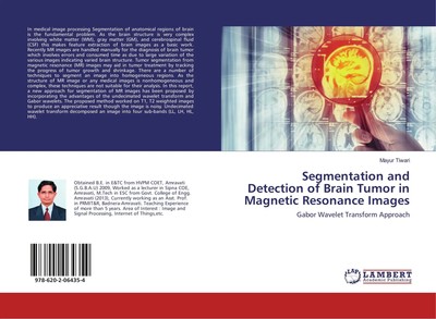 Mayur Tiwari | Segmentation and Detection of Brain Tumor in Magnetic...