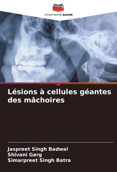 Jaspreet Singh Badwal (U. A.) | LéSions à Cellules GéAntes Des MâChoires | Buch-image