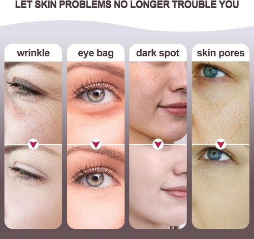 Masajeador facial de alta frecuencia 4 en 1 dispositivo de fototerapia con luz de microcorriente - Imagen 6 de 7