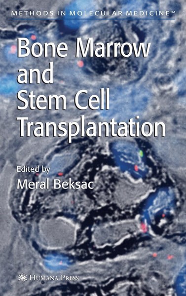 Bone Marrow And Stem Cell Transplantation Meral Beksaç-image