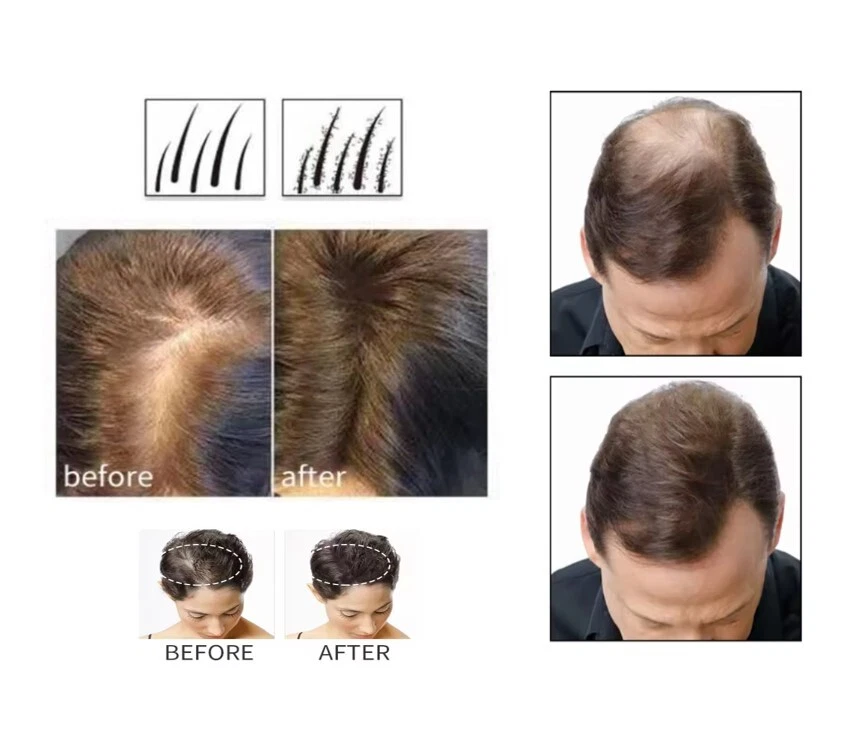 Bolsa de recarga de fibra capilar polvo espesante tratamiento de pérdida de cabello corrector queratina Foto 2 de 4