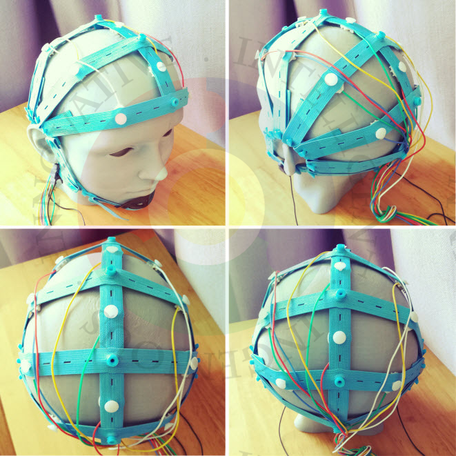 eeg 2011年 Normal EEG | Neupsy Key