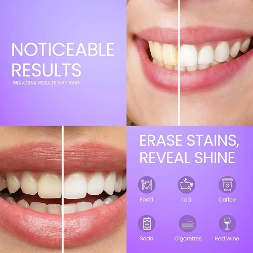 Purple whitening strips for teeth in pack of one, white box with blue text “Noticeable Results” and “Erase Stains, Reveal Shine.”