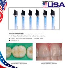 DX Dental Universal Ortho Light Cure Composite Resin Filler Material 4g/Syringe