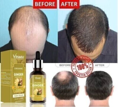 Hair Regrowth For Men Women Natural Oil Serum Grow Loss Treatment Ginger Oil