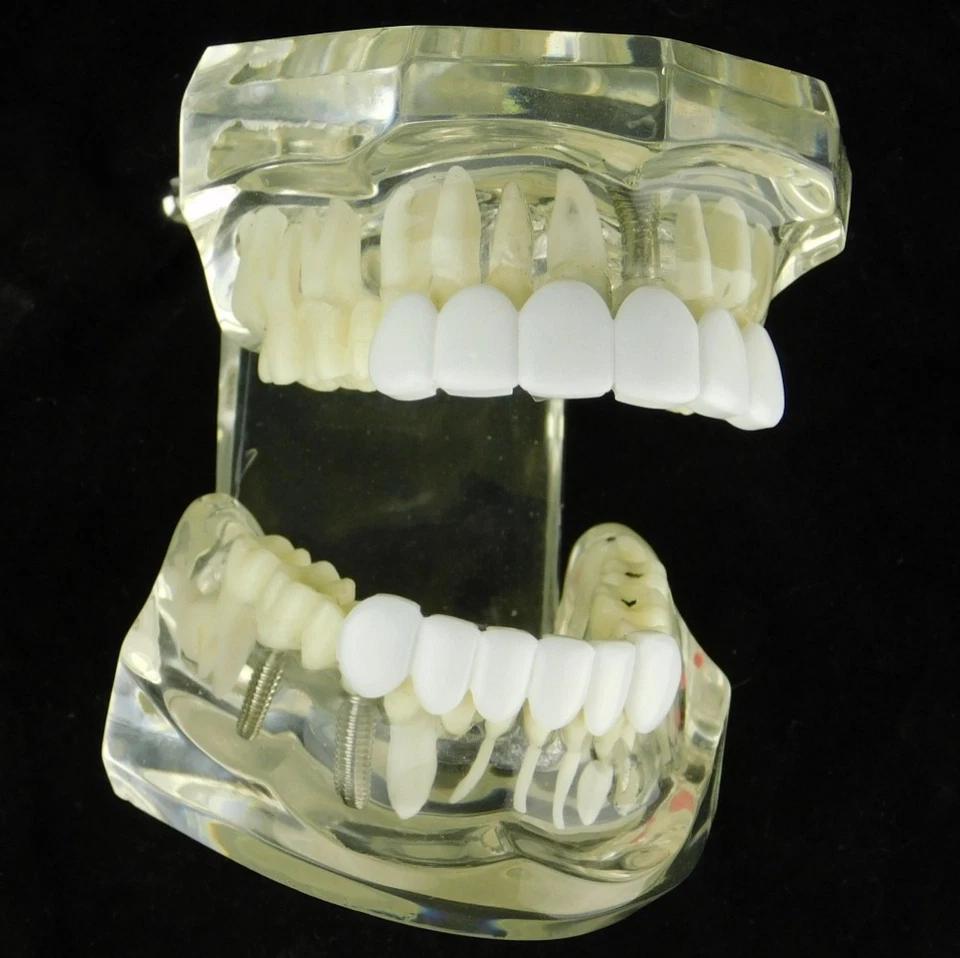 White Teeth Grillz Set Teeth Bright Smile Snap-On False Fake Grills Top & Bottom - Image 2 of 4