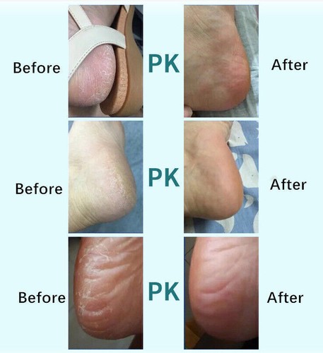 Fußpflege Pediküre Velvet Smooth elektrischer Hornhautentferner Pro Wasserfest - Bild 5 von 7