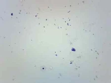 Streptococcus Pneumoniae - Gram Pos. - Prepared Slide - 75x25mm - Eisco Labs