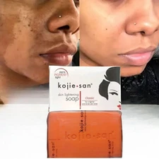 [3-pack] Kojie San Skin Lightening Face & Body Soap Bar 135g/ea,[USA Stock 🇺🇸 