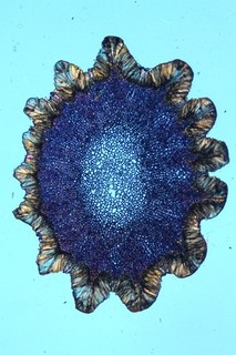 Antique microscope slide by Frederick Marshall. Cidaris. Tip of Spine. Seychelle