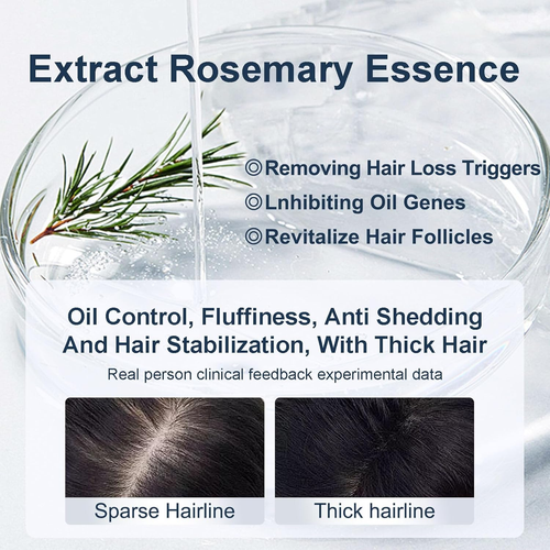 Organic Biotin Rosemary Hair Growth Shampoo for Women & Men- Thickening Shampoo - Picture 3 of 12