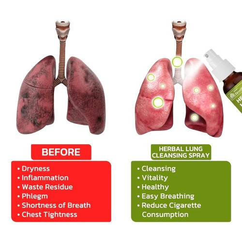 30 ml BreathDetox Pulmonar Health - Limpieza pulmonar y desintoxicación para soporte respiratorio DE - Imagen 8 de 8
