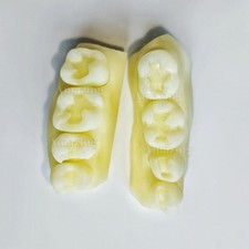 Modelo de restauración de resina compuesta ajuste dental con prueba de estudiante de dentista 3M Z350XT