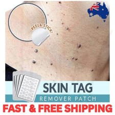 Skin Tag Remover Acne Pimple Patch Removal Facial Care Spot Plaster Blemish