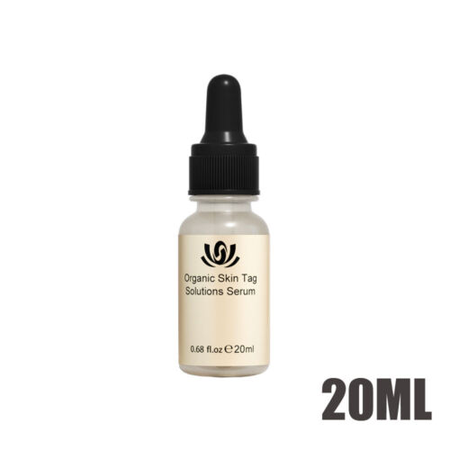 12 Hours Wart Remover Skin Tags Mole Remover Eliminate Foot Corn Wart . - Picture 5 of 12