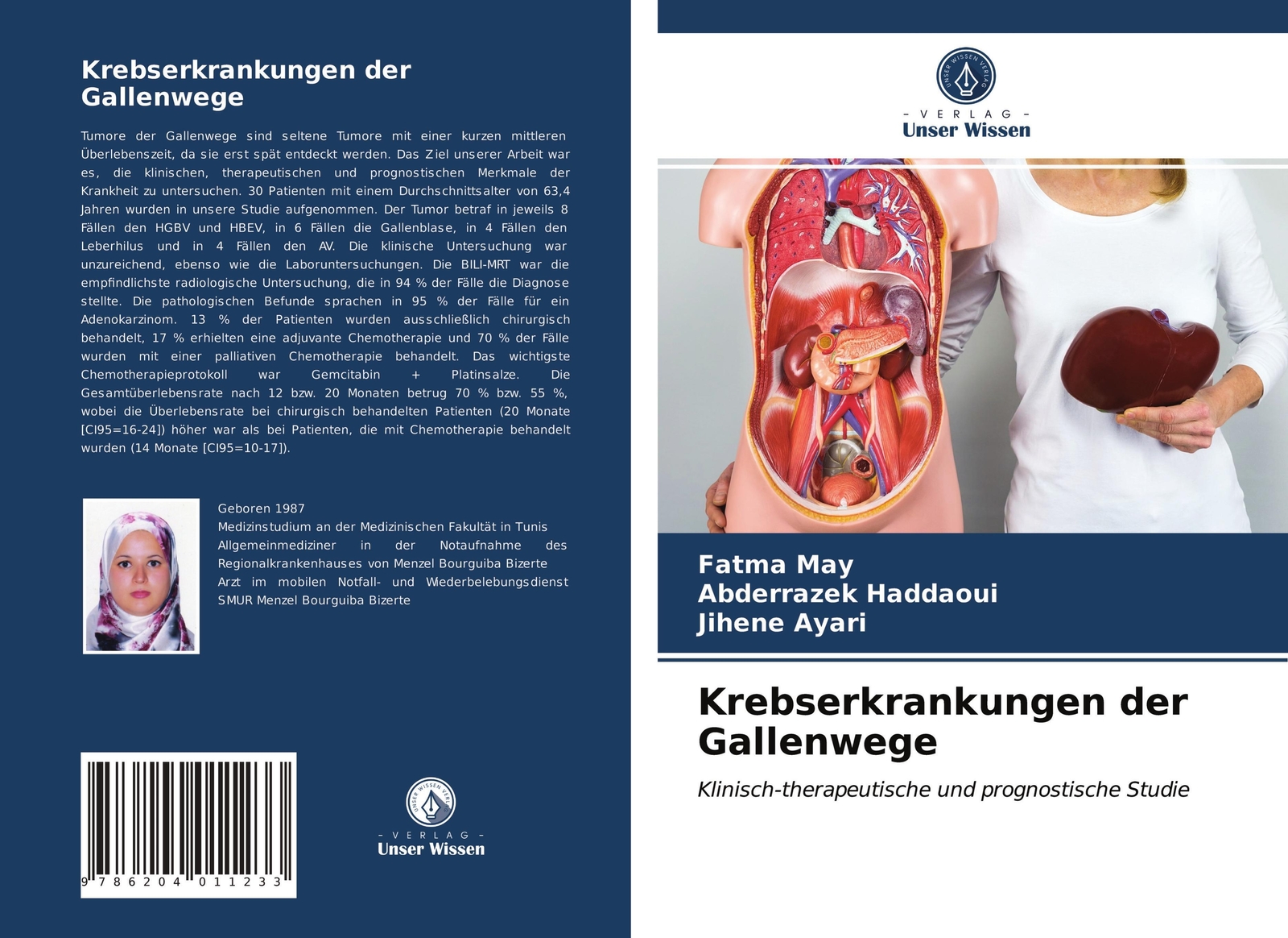 Thumbnail - Fatma May (u. A.) | Krebserkrankungen Der Gallenwege | Taschenbuch |