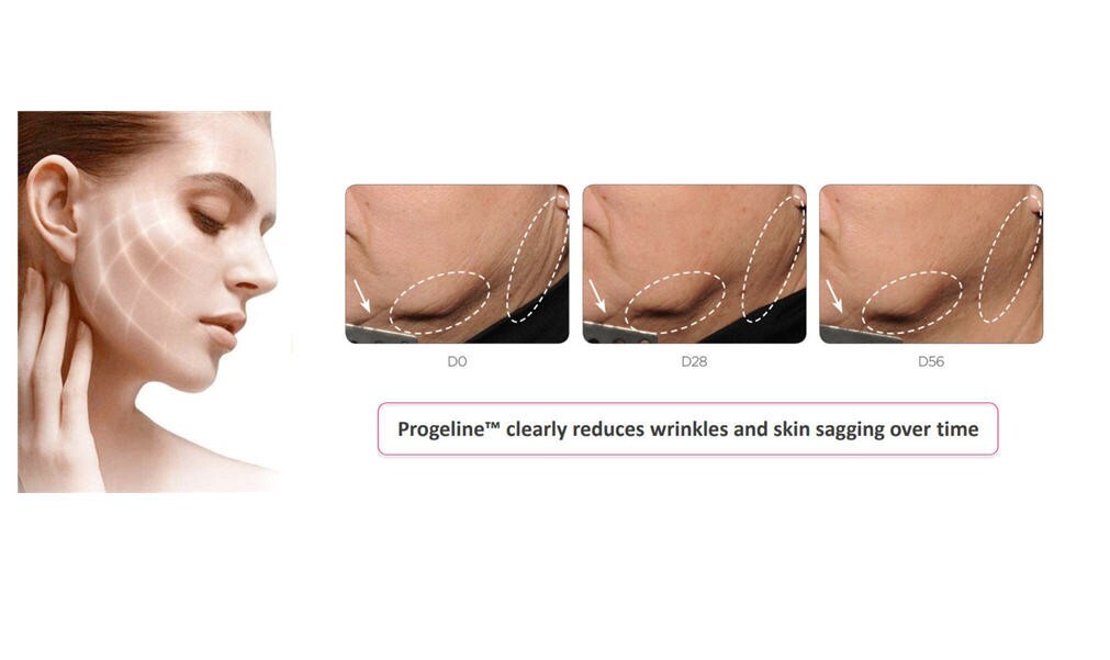 P R O G E L I N E Trifluoroacetyl Tripeptide-2 Peptide