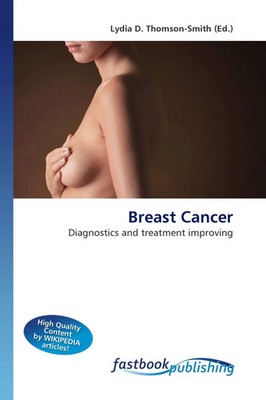 Lydia D. Thomson-Smith | Breast Cancer | Taschenbuch | Englisch (2026)