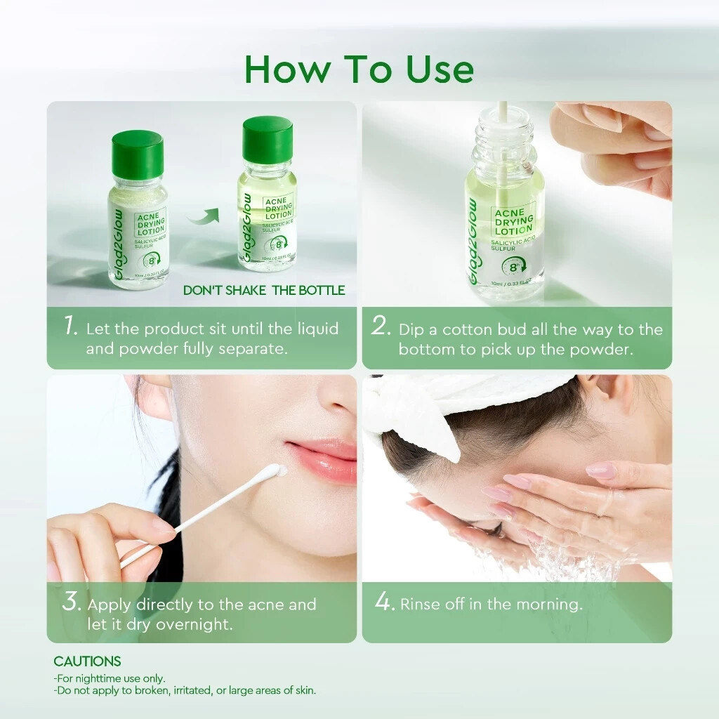 ACNE LOTION H 3点セット Glad2Glow Acne Lotion 10 ml Serum Acne Treament Pimple Acne