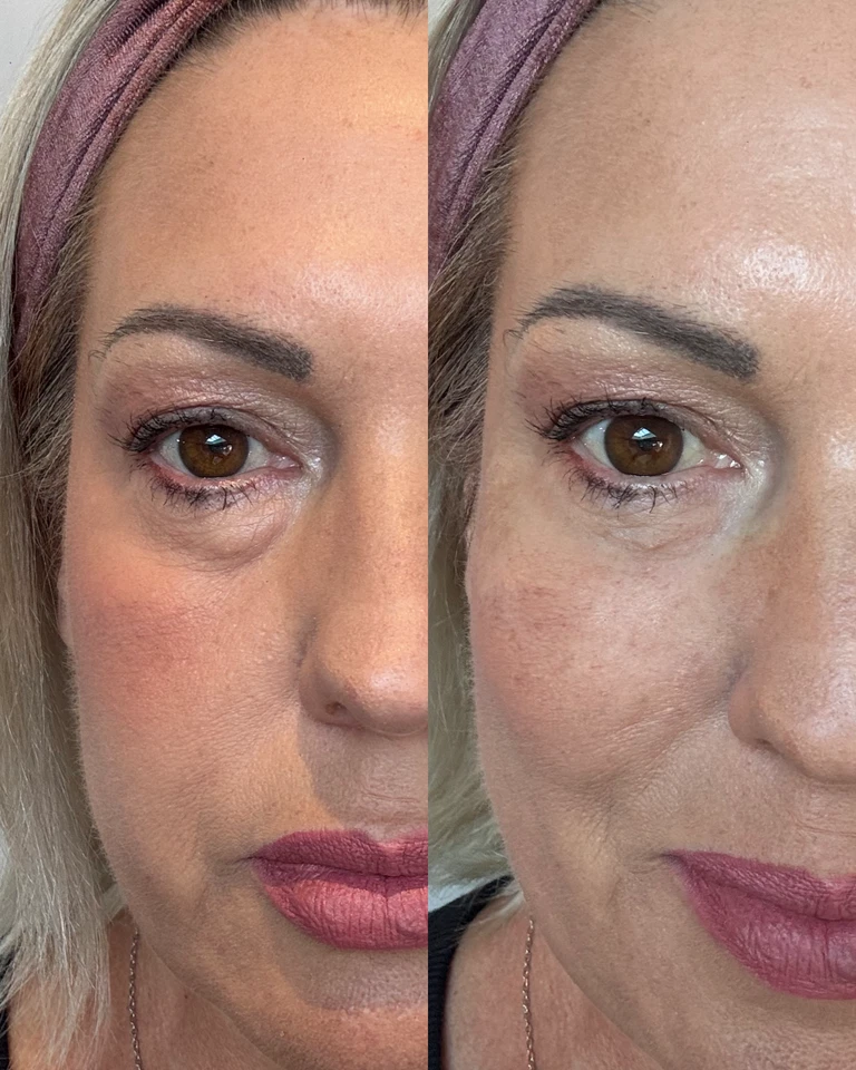 The Original Eyesential (20ml Bottle) Removes wrinkles, fine lines in seconds... - Image 4 of 4