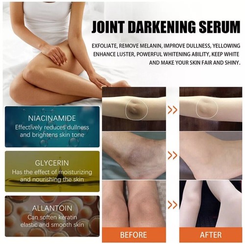 Strong Whitening Dark Skin Knuckles Feets Knees Elbows Armpit inner Thigh Serum - Picture 5 of 11
