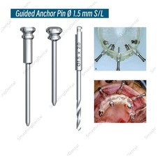  1.5 Dental Guided Anchor Pin Digital Guided Implant Fix Pins Guided Sleeves